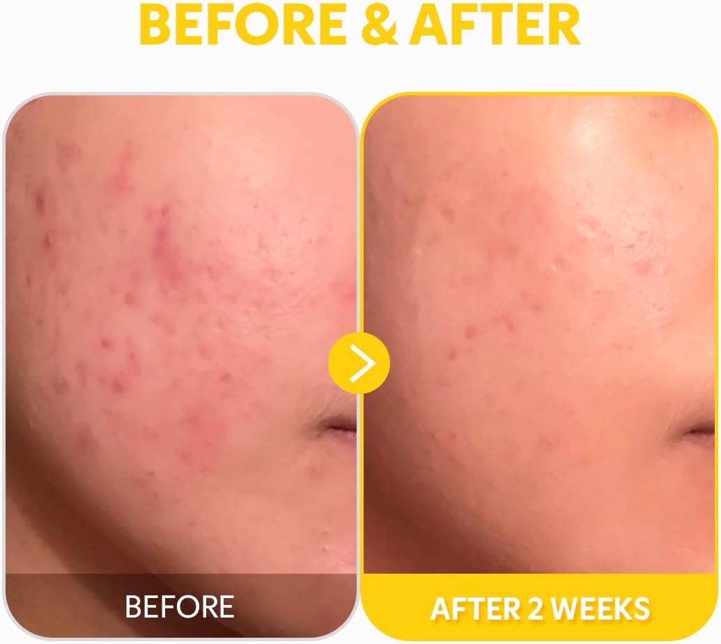 TIRTIR PURE VITAMIN C 24% SERUM 30ml