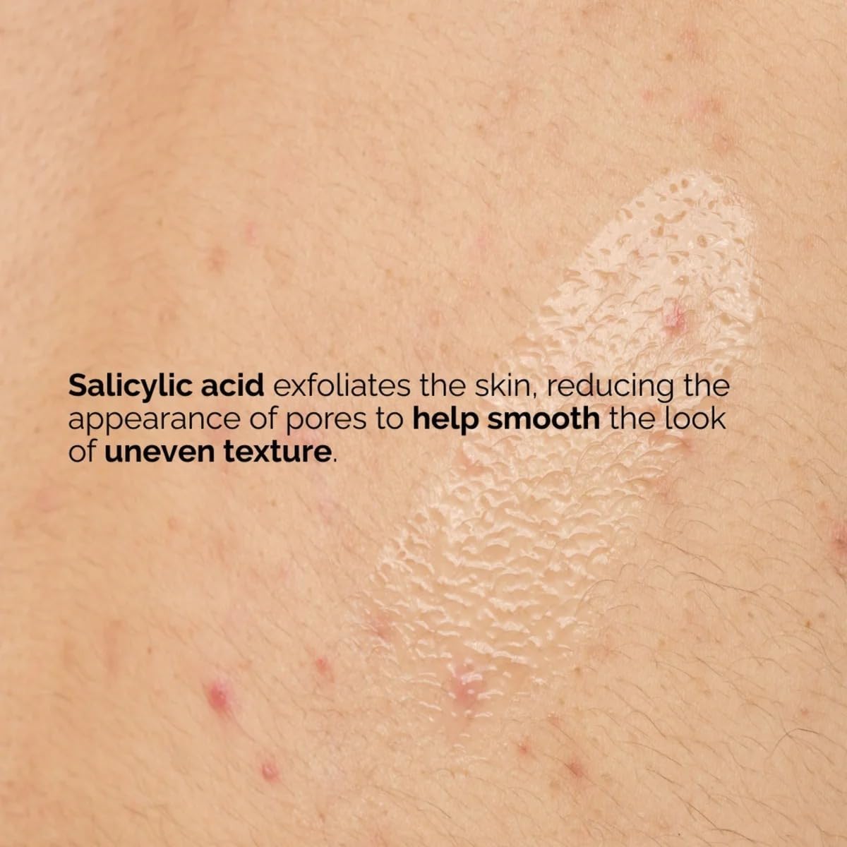 The Ordinary | Salicylic Acid 0.5% Body Serum | 240ml