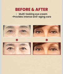 Seoul 1988 Anti-Aging Eye Cream