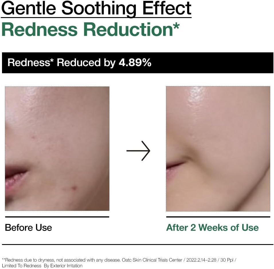 Anua Soothing Ampoule for Irritated Skin 30ml