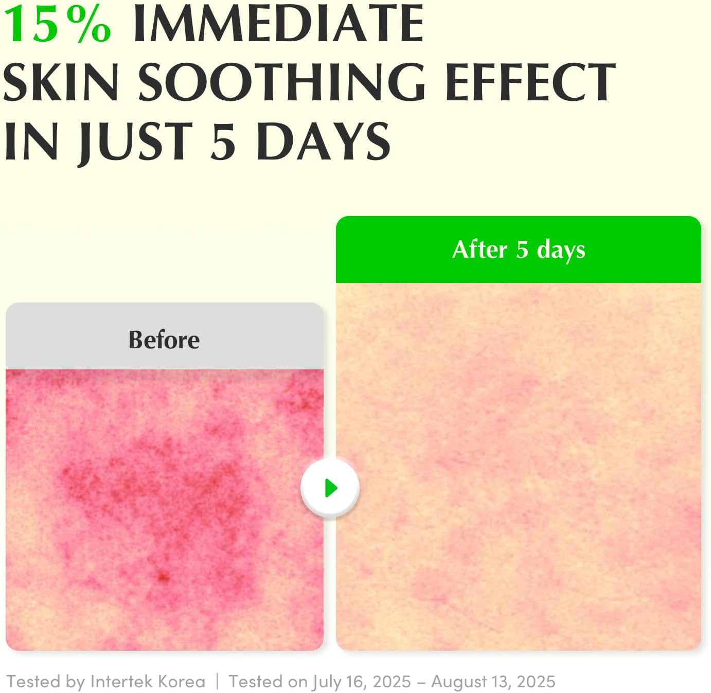 EQQUALBERRY Aloe PDRN Soothing Serum