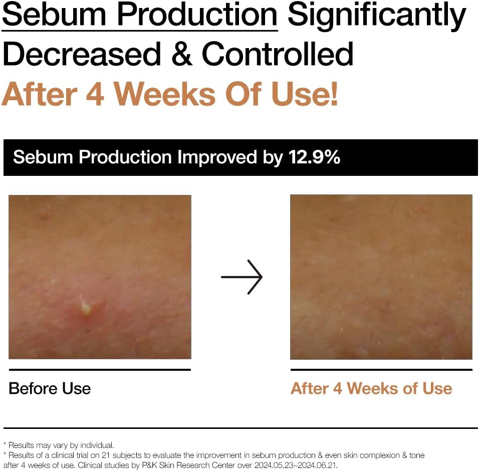 ANUA RICE 70 GLOW MILKY TONER 250ml