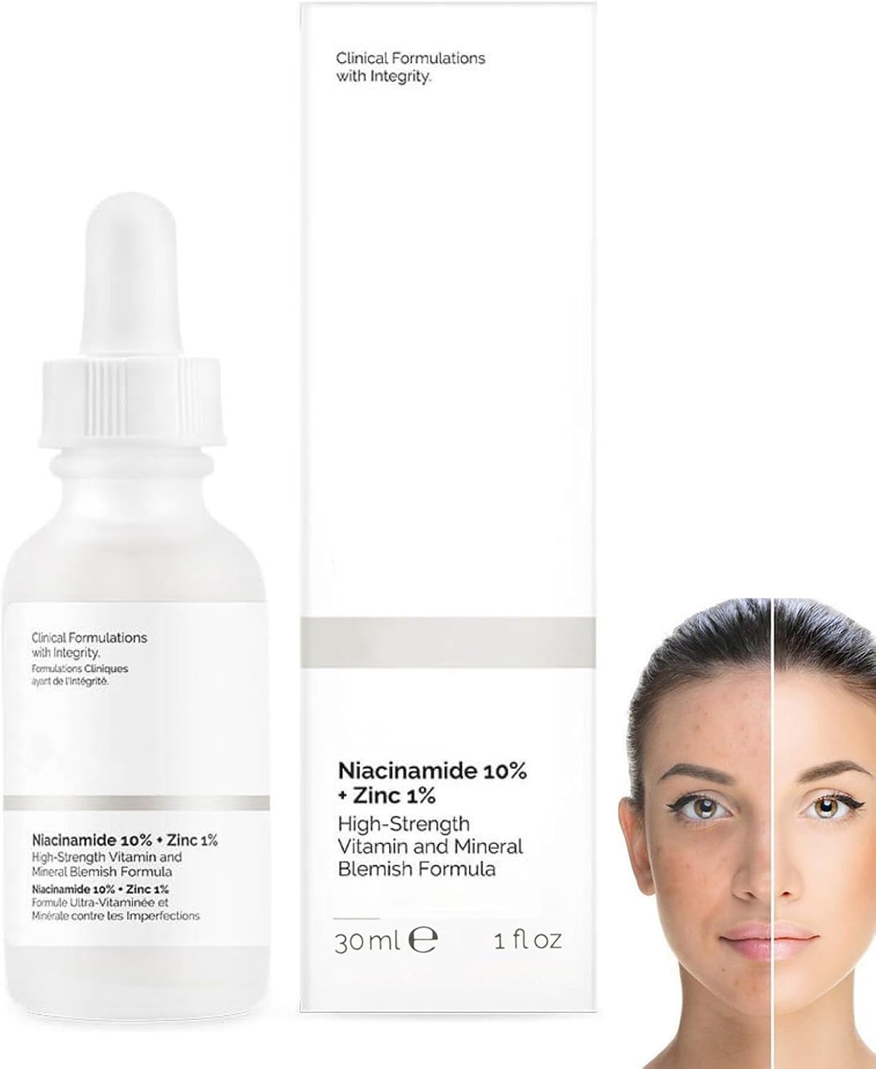 Niacinamide Serum, 10% Niacinamide + 1% Zine Face Serum, Hydrating Face Moisturiser For Balance Grease, Minimise Pores, Tackles Blemishes, Improve Dull Skin, Brightening & Glow Skin 30ML