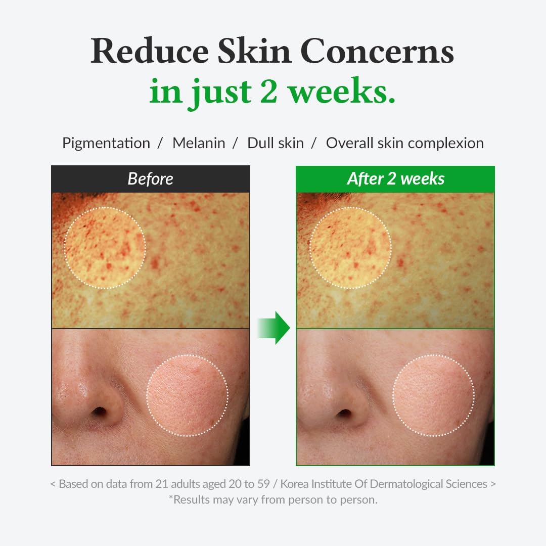 Dr.Althea Gentle Vitamin C Serum 20%