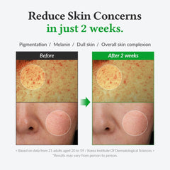 Dr.Althea Gentle Vitamin C Serum 20%