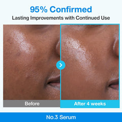 numbuzin No.3 Serum | Blue Retinol Pore Refining Serum | Pore Tightening, Firming, Anti-Aging, Korean Skincare