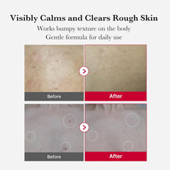 Medicube Strawberry Body Exfoliating Spray