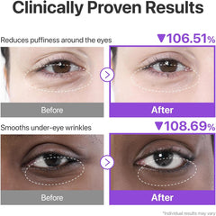 numbuzin No.9 Eye Patches | NAD+ Collagen Under Eye Patches | Dark Circles, Cooling, Puffy Eyes, Eyebags