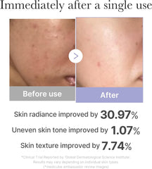 Medicube Booster Pro Mini