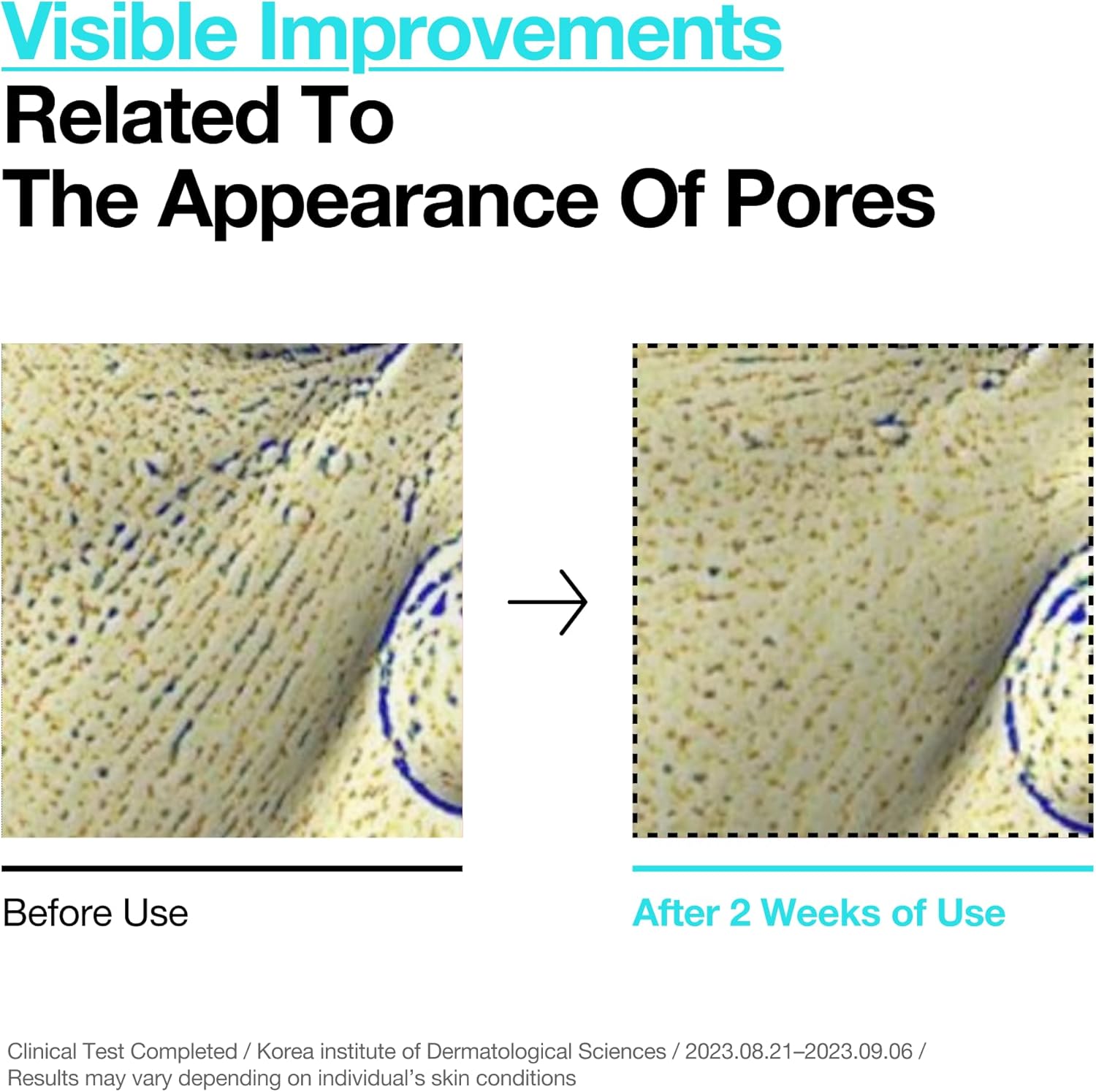 ANUA BHA 2% GENTLE EXFOLIATING TONER 150ml