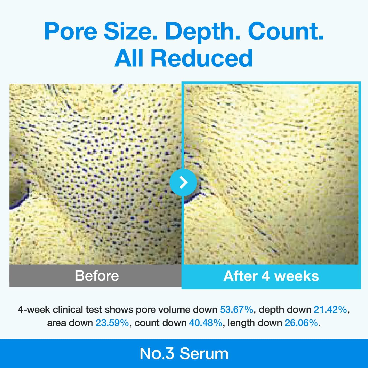 numbuzin No.3 Serum | Blue Retinol Pore Refining Serum | Pore Tightening, Firming, Anti-Aging, Korean Skincare