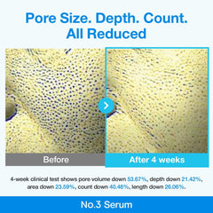 numbuzin No.3 Serum | Blue Retinol Pore Refining Serum | Pore Tightening, Firming, Anti-Aging, Korean Skincare