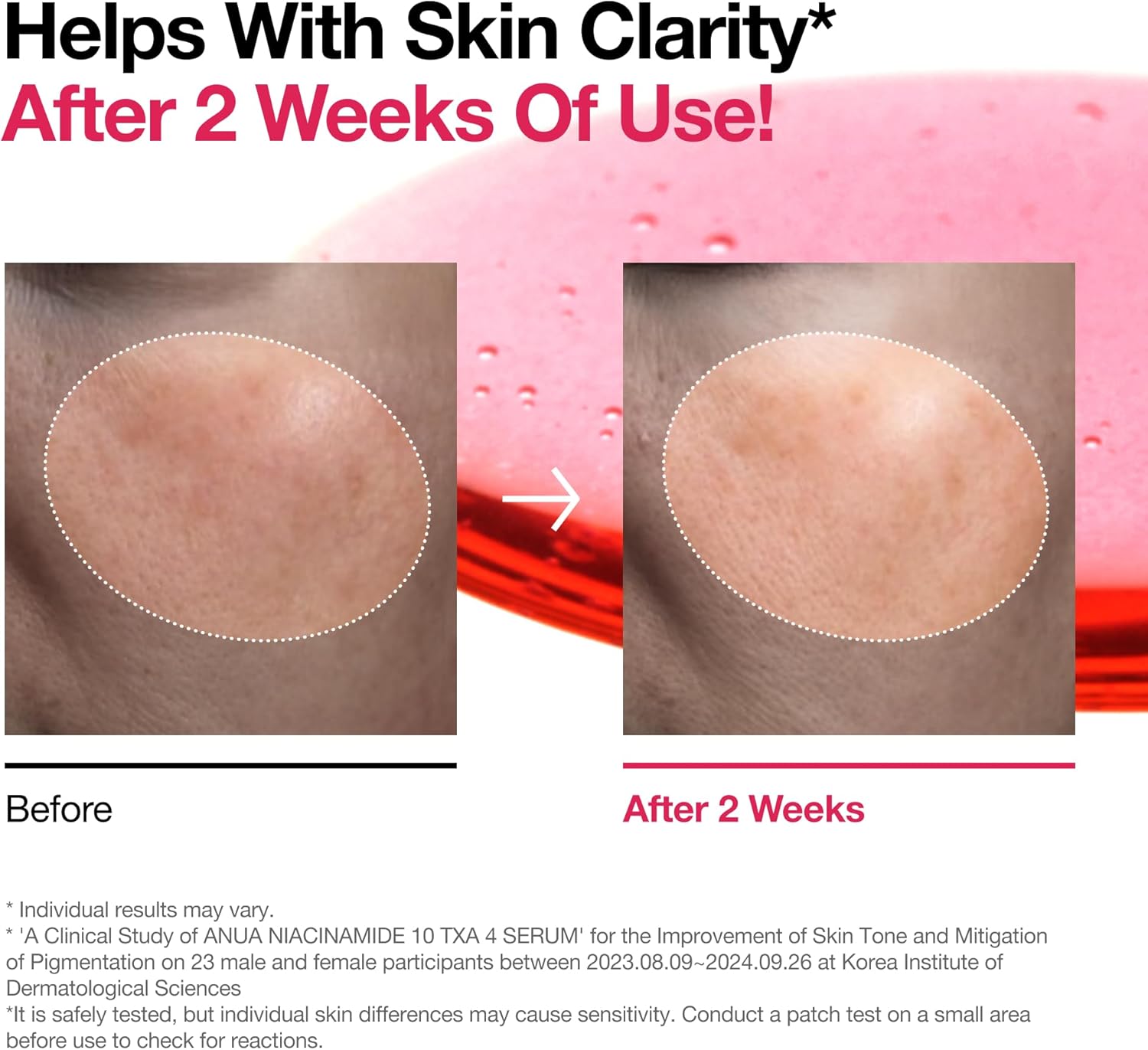 Anua 10% Niacinamide Serum