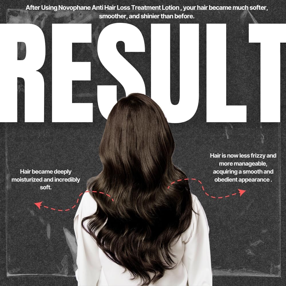 ACM Novophane Hair Loss Lotion, 100 ml