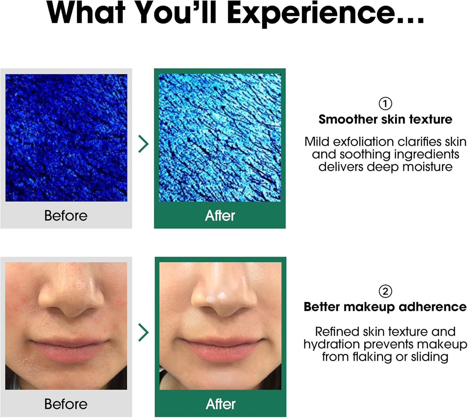 SOME BY MI 30 Days Miracle Toner by SomeByMi