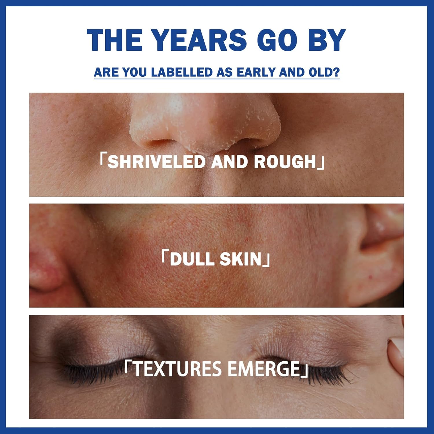 Niacinamide Serum, 10% Niacinamide + 1% Zine Face Serum, Hydrating Face Moisturiser For Balance Grease, Minimise Pores, Tackles Blemishes, Improve Dull Skin, Brightening & Glow Skin 30ML