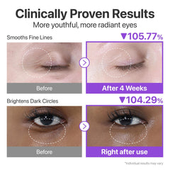 numbuzin No.9 NAD+ Retinol Eye Cream, Depuffing & Firming Eye Serum for Dark Circles