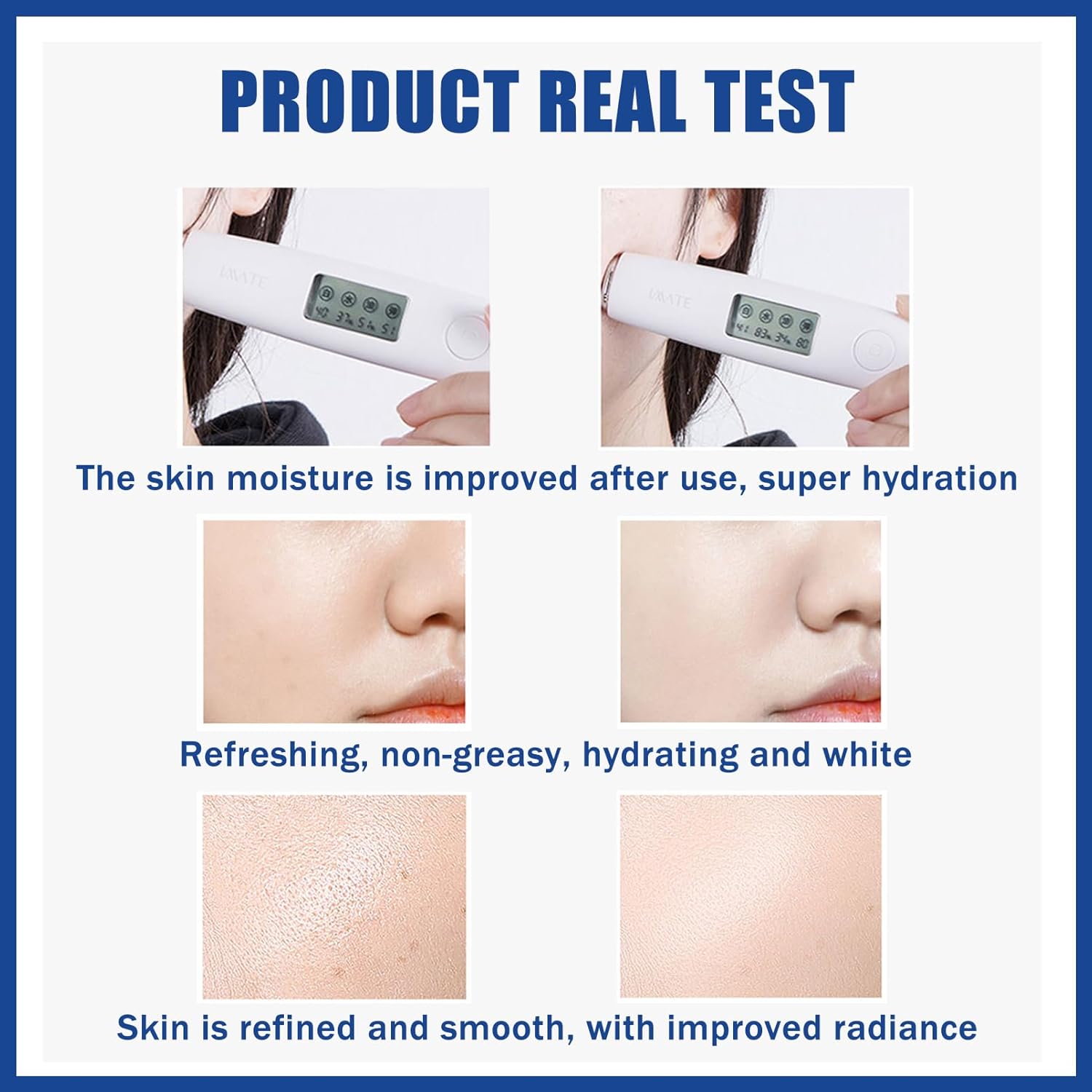 Niacinamide Serum, 10% Niacinamide + 1% Zine Face Serum, Hydrating Face Moisturiser For Balance Grease, Minimise Pores, Tackles Blemishes, Improve Dull Skin, Brightening & Glow Skin 30ML