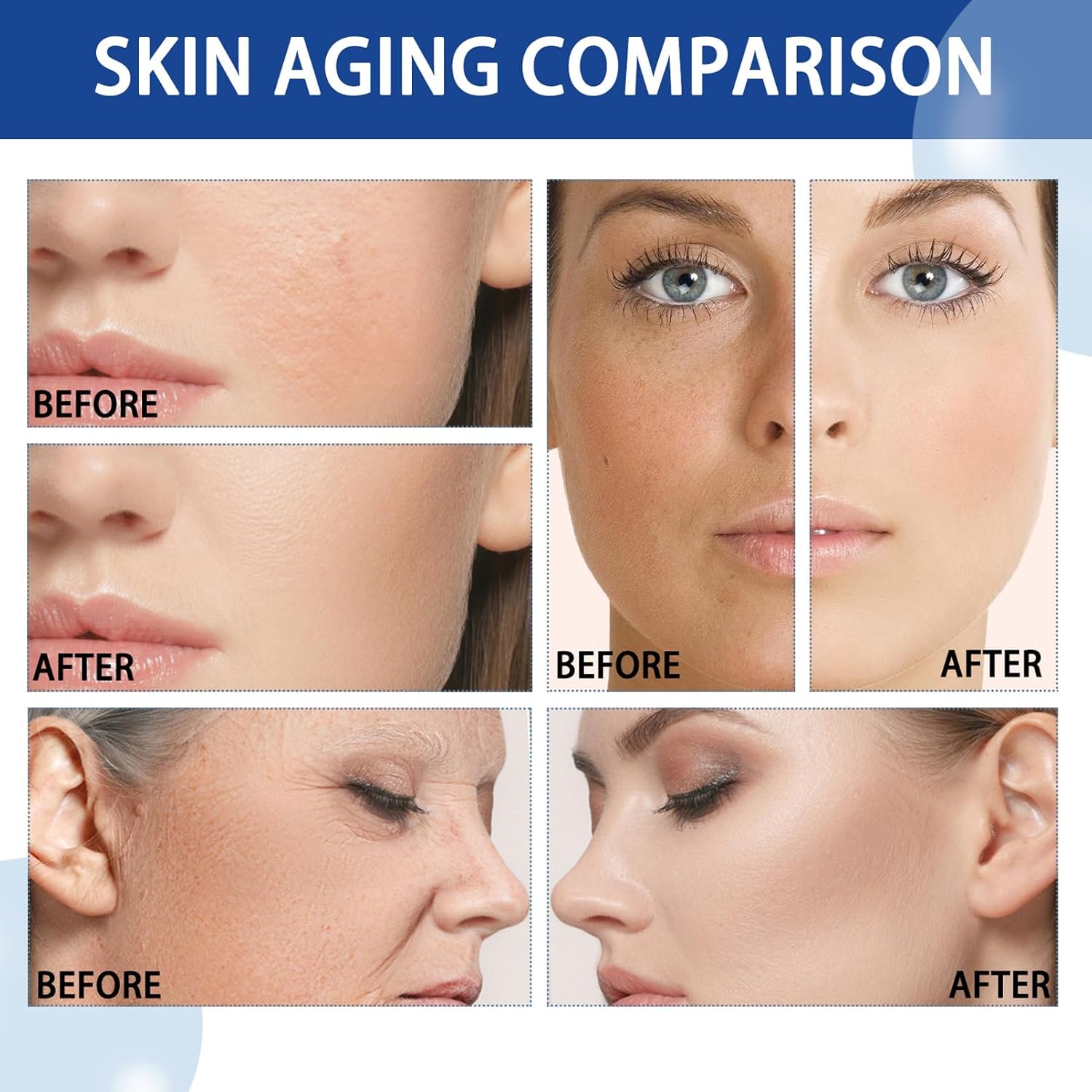 Niacinamide Serum, 10% Niacinamide + 1% Zine Face Serum, Hydrating Face Moisturiser For Balance Grease, Minimise Pores, Tackles Blemishes, Improve Dull Skin, Brightening & Glow Skin 30ML