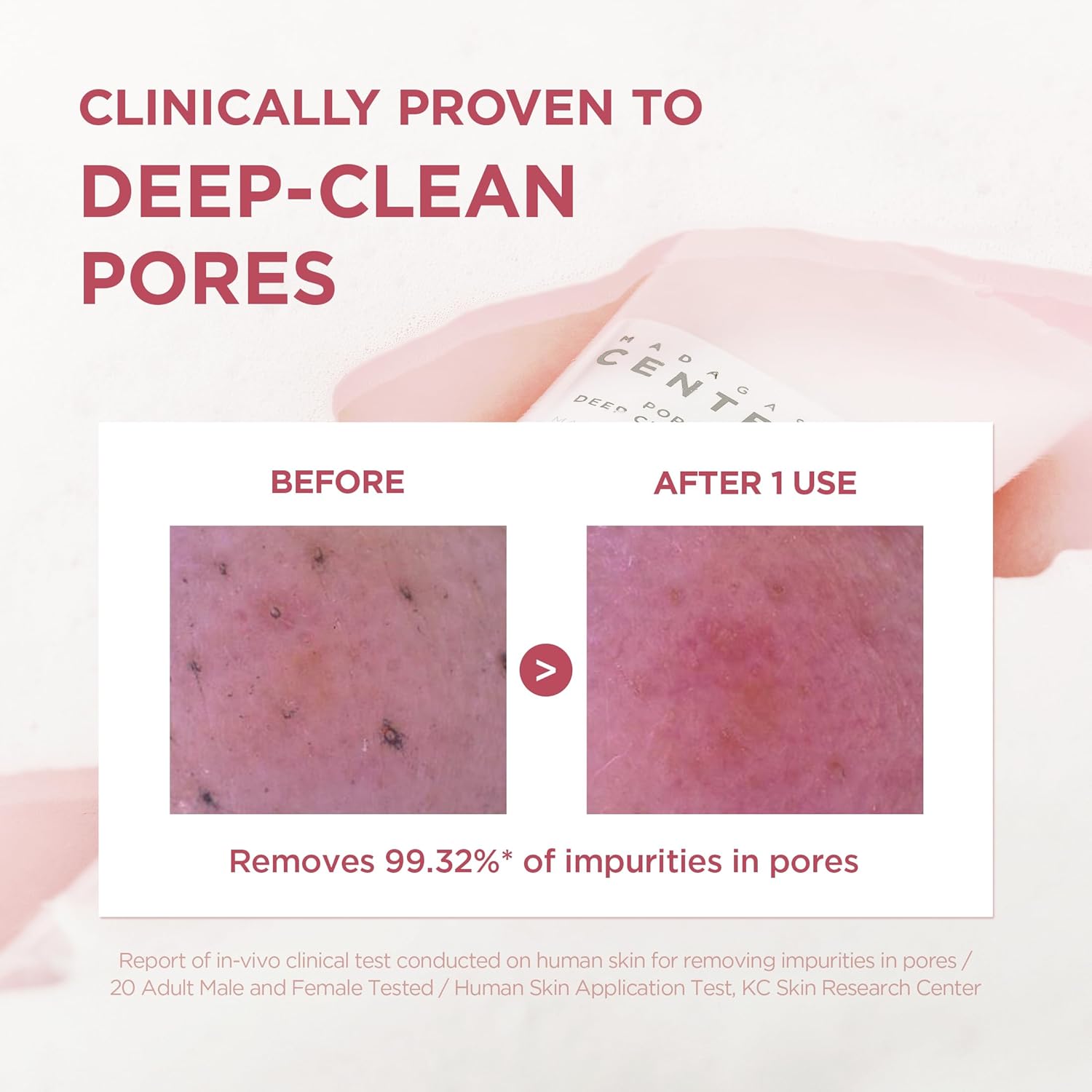 Skin1004 Madagascar Centella Poremizing Deep Cleansing Foam 125 Ml