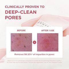 Skin1004 Madagascar Centella Poremizing Deep Cleansing Foam 125 Ml