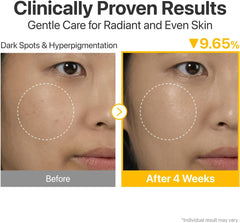 numbuzin No.5+ Vitamin Concentrated Serum | Glutathione & Vitamin Serum, Dark Spot, Korean Skincare 1.01fl.oz/30ml