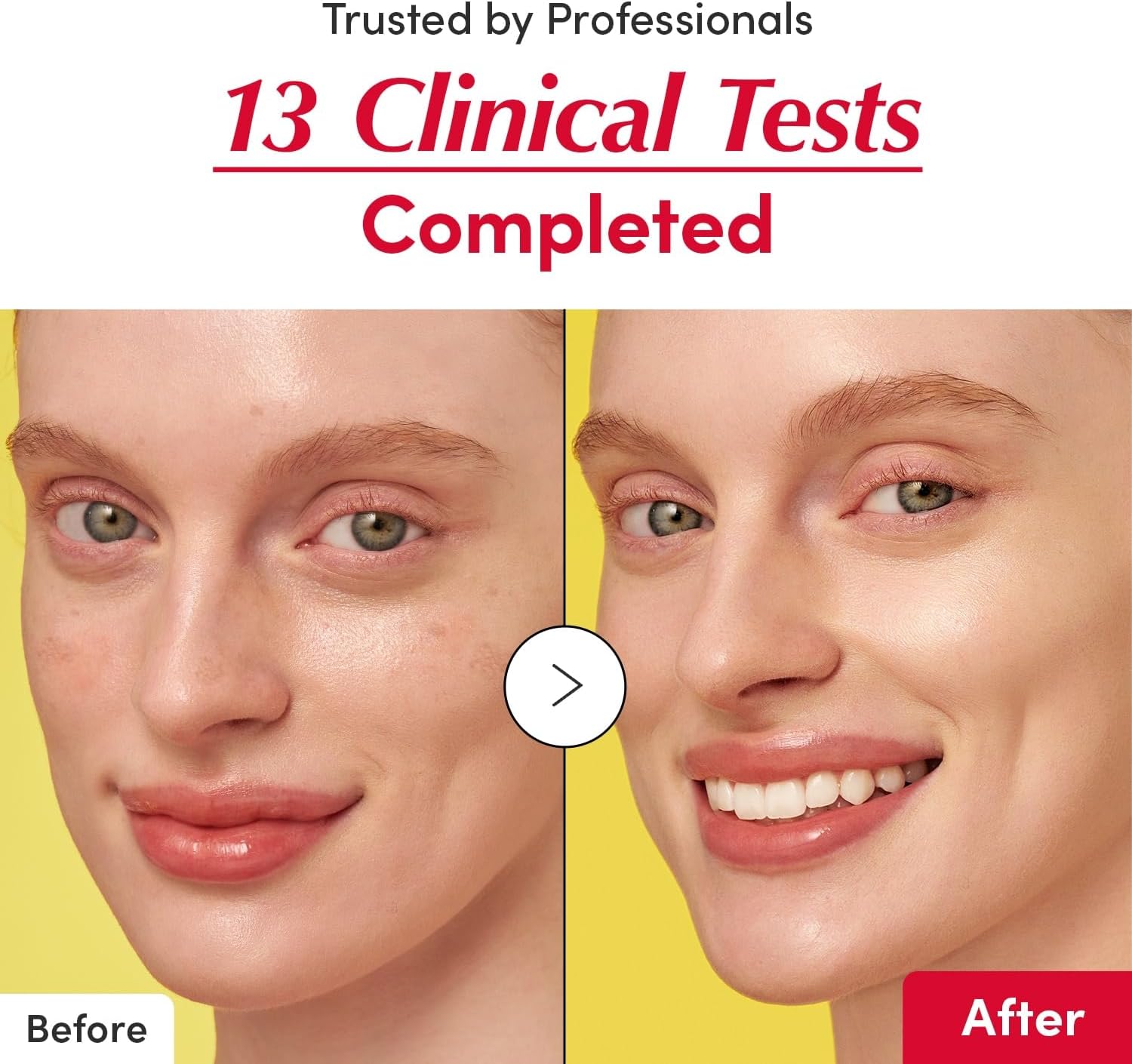 Eqqual Berry Deep Cera Vitamin Illuminating Serum 30Ml