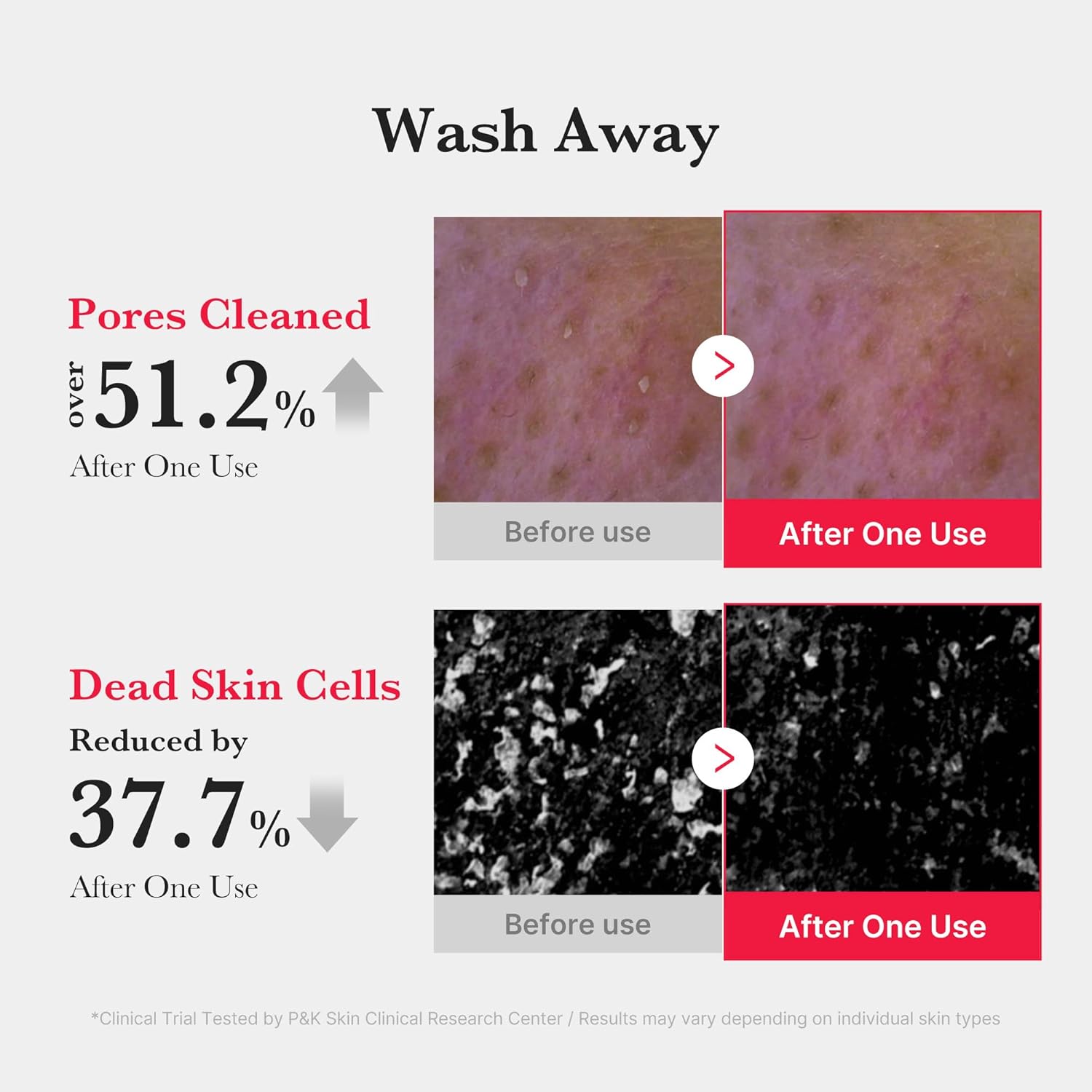 Medicube Red Foam Cleanser || A deep cleanse that helps relieve skin | Suitable for Acne-prone skin | Formulated with 0.45% Salicylic Acid | Korean skincare (120g)