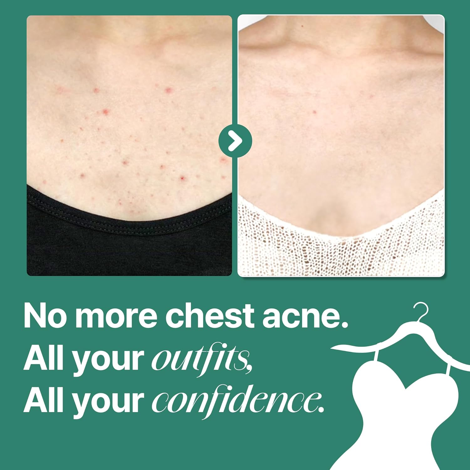 Some By Mi Aha Bha Pha 30 Days Miracle Acne Clear Body Cleanser 400G