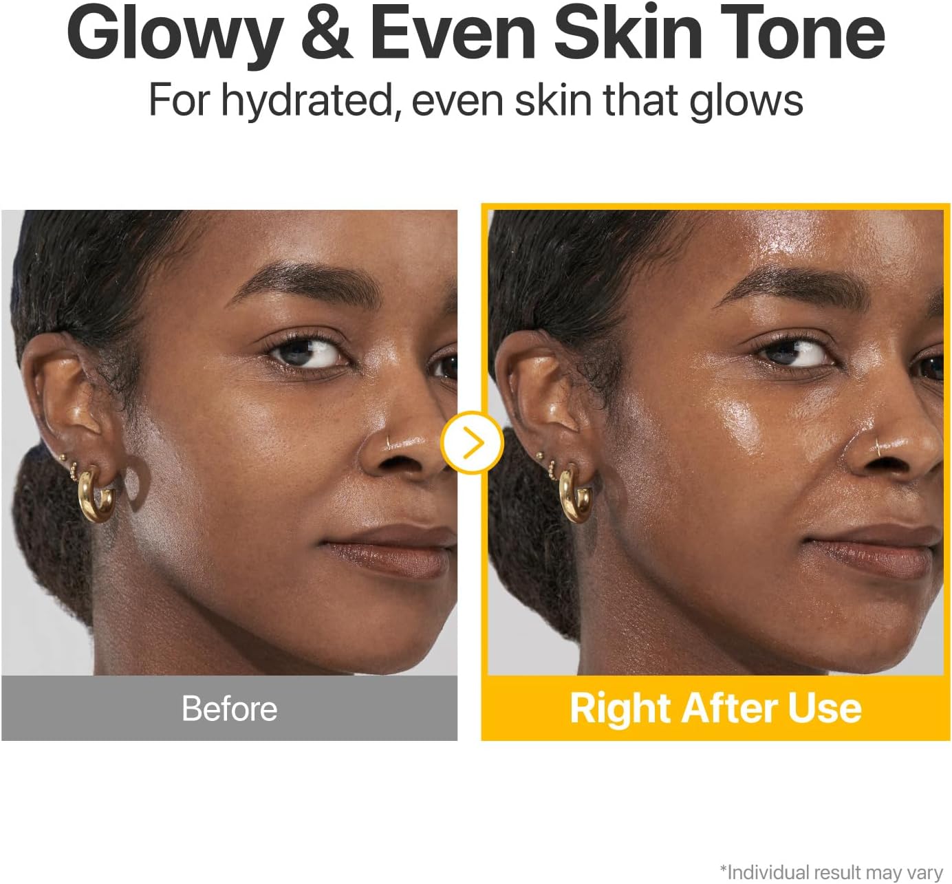 numbuzin No.5+ Vitamin Concentrated Serum | Glutathione & Vitamin Serum, Dark Spot, Korean Skincare 1.01fl.oz/30ml