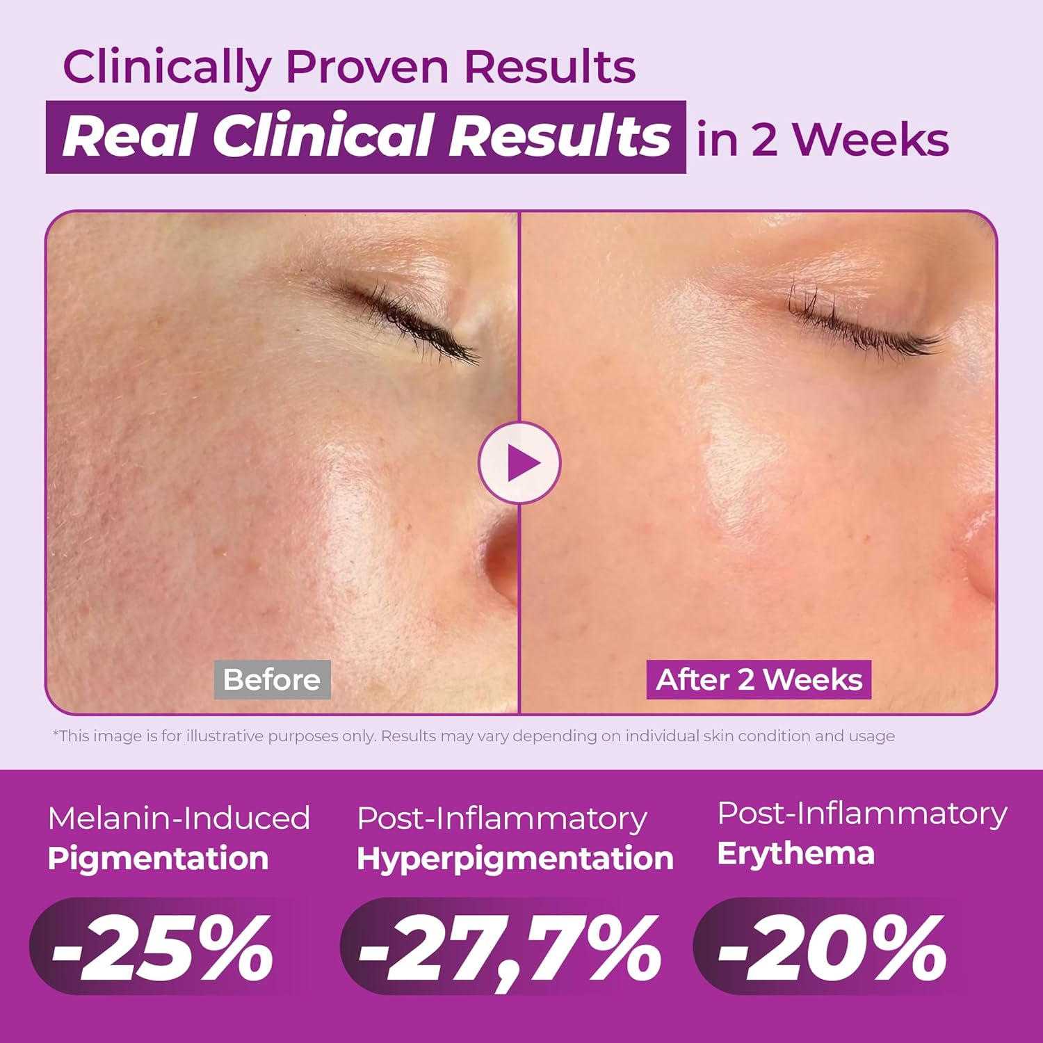 JUMISO Niacinamide 20 Serum - Korean Face Serum with Glutathione, TXA Tranexamic Acid and Centella Complex